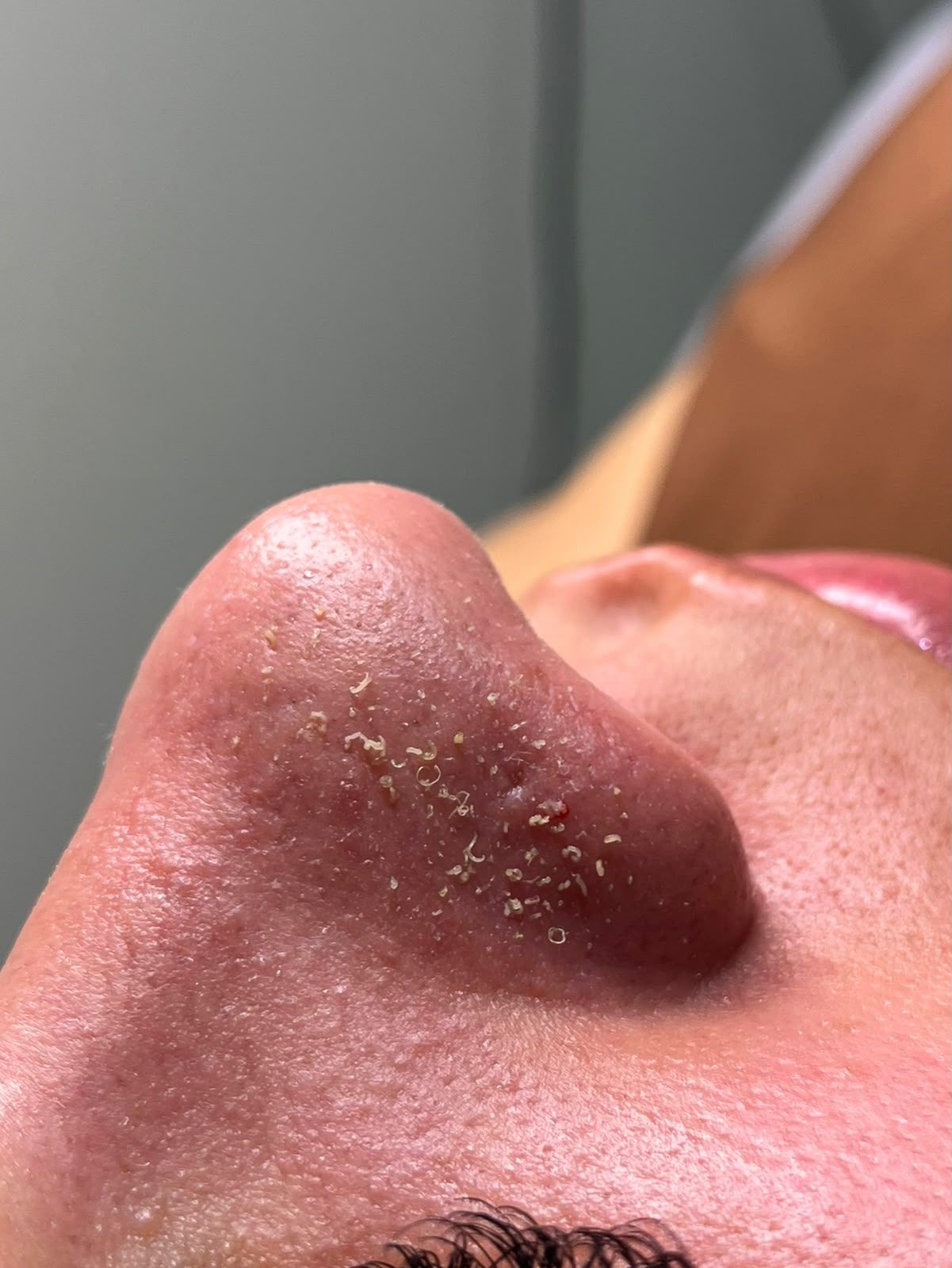 Limpeza de Pele Premium
