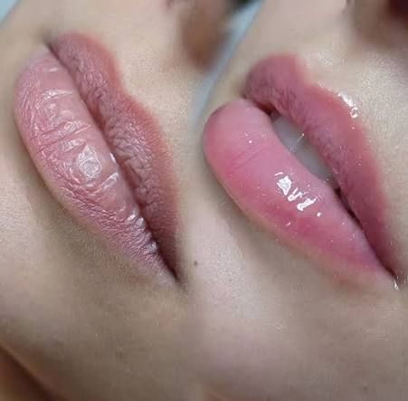 Hydra Lips Gloss