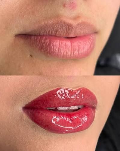 Hydra Collor